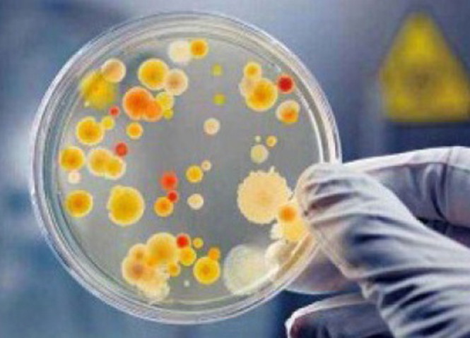 原位有机污染园地修复- 强化微生物修复